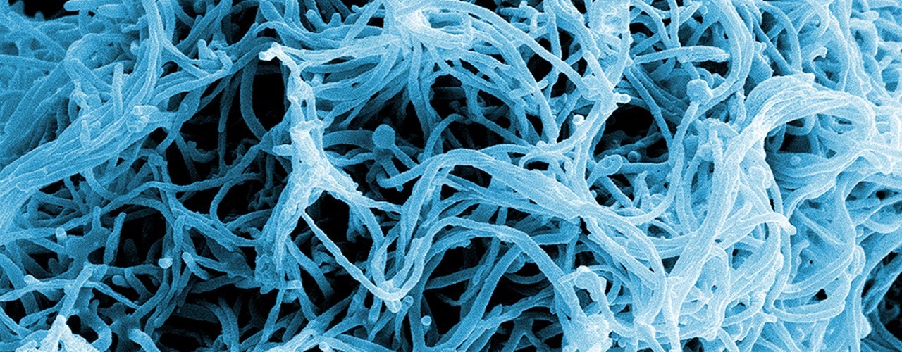 Ebola
